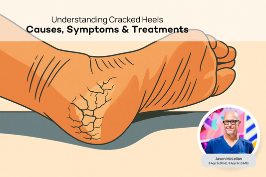 What are Cracked Heels? A Podiatrist Explains the Causes and Treatment